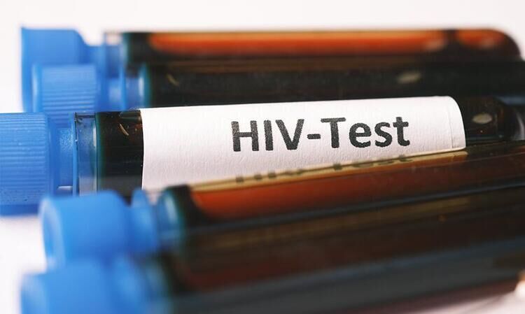 ‘അമിതമായ ക്ഷീണം, ഇടക്കിടെയുള്ള പനി, അകാരണമായ വയറിളക്കം, ശരീരഭാരം പെട്ടെന്ന് കുറയുക എന്നിവ എയ്ഡ്‌സ് റിലേറ്റഡ് കോംപ്ലക്‌സ് ആയി കണക്കാക്കാം’