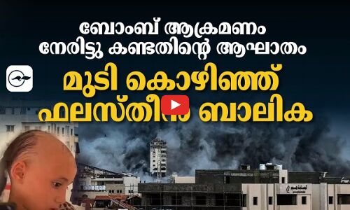 ബോംബ് ആക്രമണം നേരിട്ടു കണ്ടതിന്റെ ആഘാതം ; മുടി കൊഴിഞ്ഞ് ഫലസ്തീൻ ബാലിക