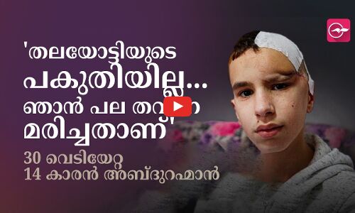 തലയോട്ടിയുടെ പകുതിയില്ല.. ഞാൻ പല തവണ മരിച്ചതാണ്: 30 വെടിയേറ്റ 14കാരൻ അബ്ദുറഹ്മാൻ അൽ സെഗൽ