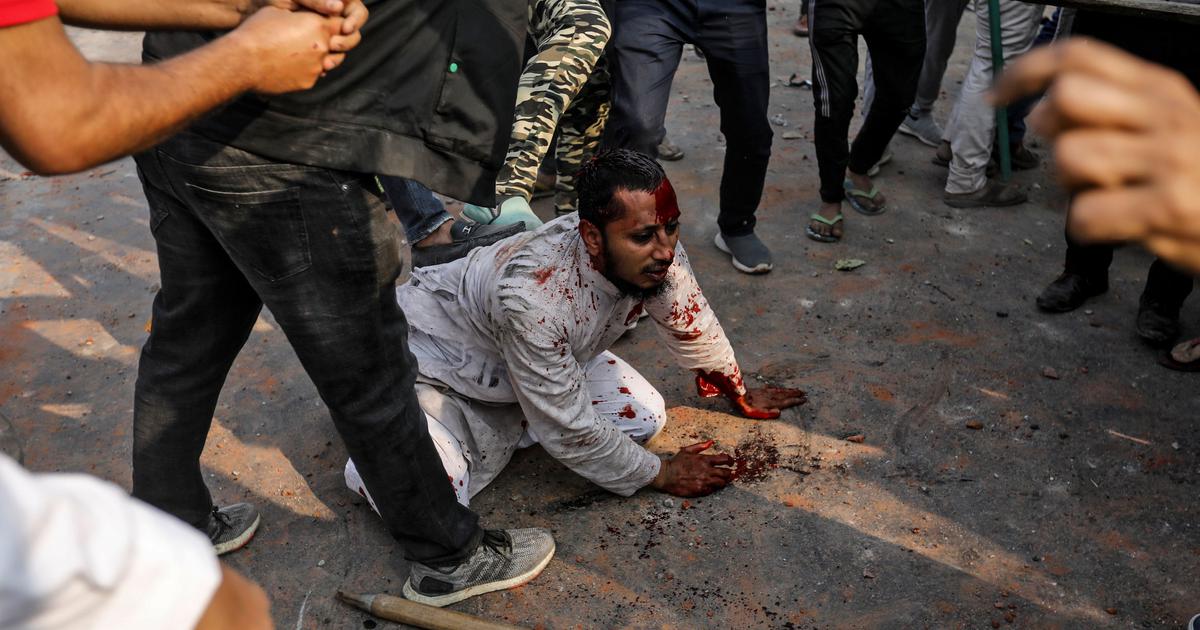 ‘ഡൽഹി ഒരു ദേശീയനാണക്കേടാണിന്ന്​’