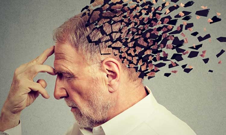 Alzheimer's-disease Alzheimer's-disease