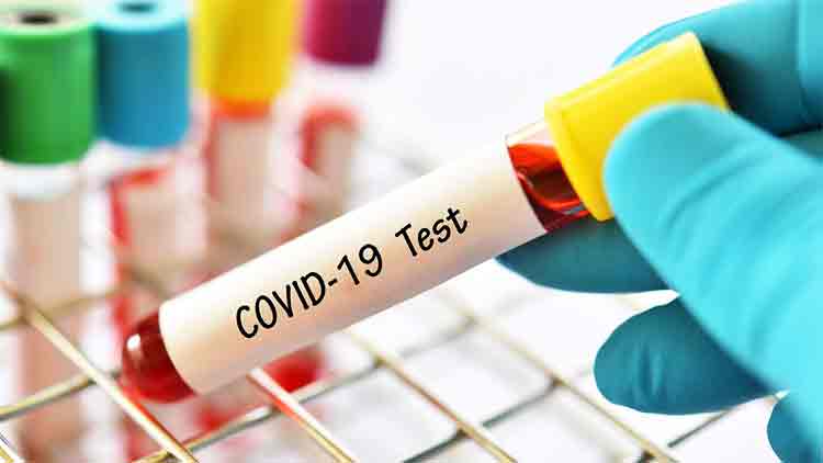 സൗദി അറേബ്യയിൽ വ്യാഴാഴ്​ച 3092 രോഗമുക്തർ; 2238 പുതിയ രോഗികൾ