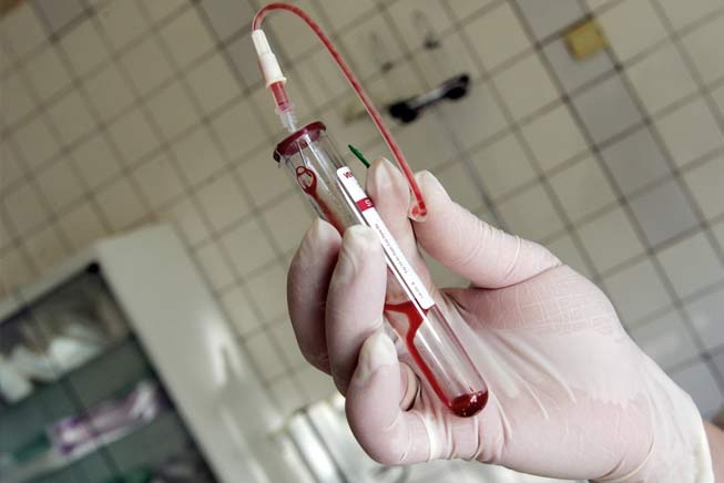 മ​ജ്ജ മാ​റ്റി​വെ​ക്ക​ൽ ചി​കി​ത്സ: എ​ച്ച്.​െ​എ.​വി ബാ​ധി​ത​ന്​ ‘രോ​ഗ​മു​ക്​​തി’