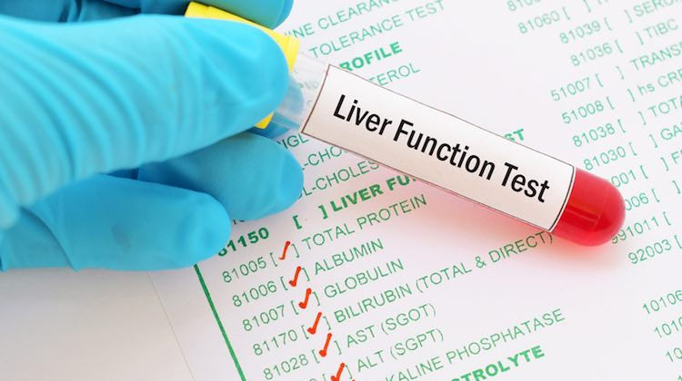 Liver-Function-Test