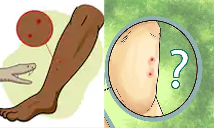 ഈ ലക്ഷണങ്ങൾ കണ്ടിട്ടും ആ അധ്യാപകർ എന്തേ അനങ്ങിയില്ല?