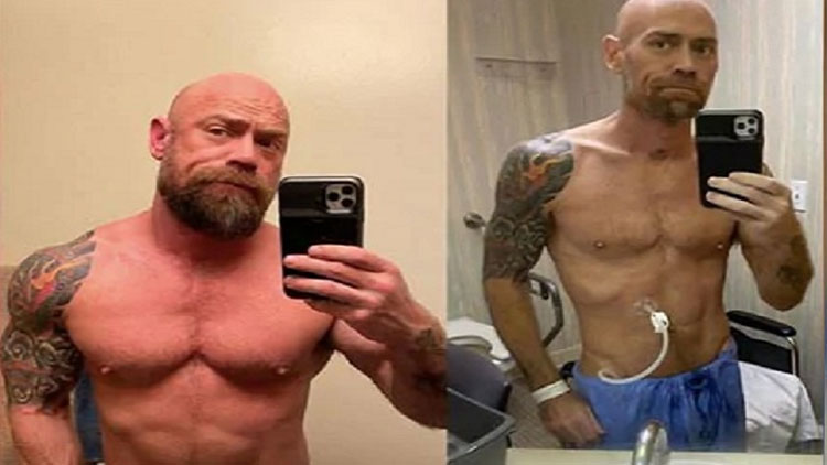 Then-and-Now-pics-of-COVID-survivor