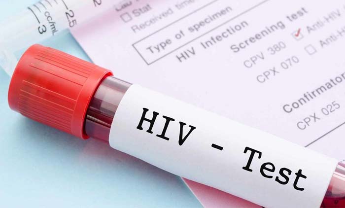 എ​യ്​​ഡ്​​സ്​ പ​രി​ശോ​ധ​ന ക്ലി​നി​ക്കു​ക​ളി​ൽ  എ​ത്തു​ന്ന​വ​രു​ടെ എ​ണ്ണം കൂ​ടി