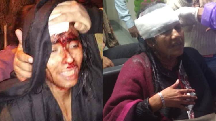 ജെ.എൻ.യു എ.ബി.വി.പി അക്രമം; ഐ​​​ഷി ഘോ​​​ഷി​​​െ​ൻ​റ​​യും അ​​​ധ്യാ​​​പി​​​ക സു​​​ചി​​​ത്ര സെ​​​ന്നി​െ​ൻ​റ​​യും ത​​​ല അ​​​ടി​​​ച്ചു​​​പൊ​​​ട്ടി​​​ച്ചു