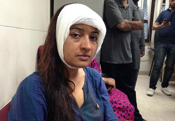 ആം ആദ്മി എം.എല്‍.എ അല്‍ക ലാംബക്ക് കല്ലേറില്‍ തലക്ക് പരിക്ക്