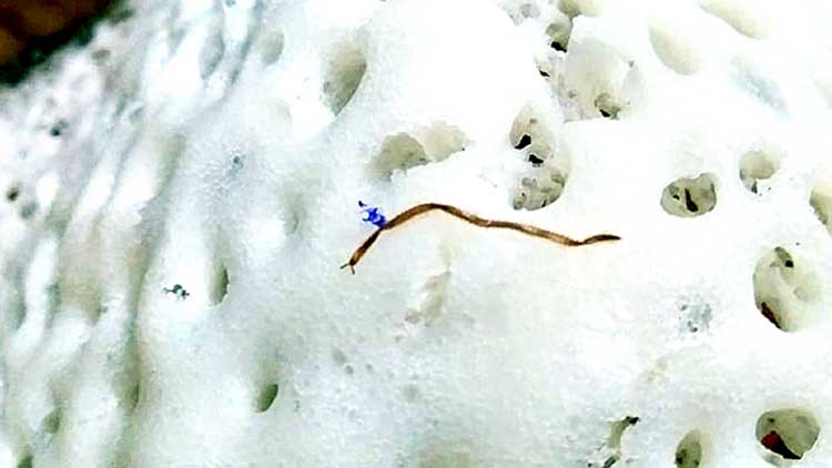 ആ​ല​പ്പു​ഴ മെ​ഡി​ക്ക​ൽ കോ​ള​ജ് ആ​ശു​പ​ത്രി  കാൻറീനിലെ ഭക്ഷണത്തിൽ ചെവിപ്പാമ്പ്