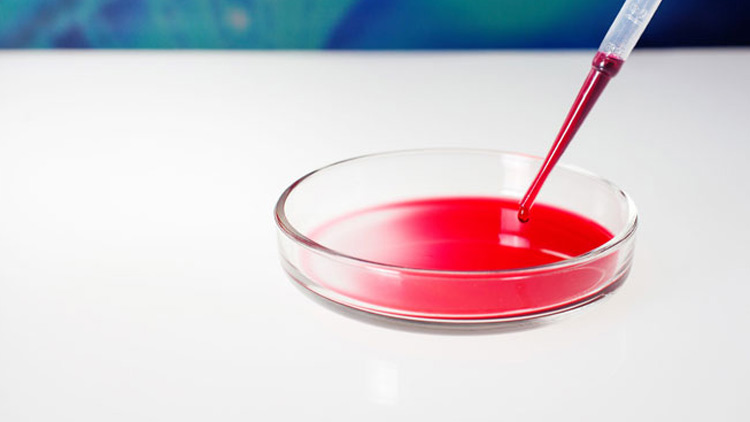 blood-testing.jpg blood-testing.jpg