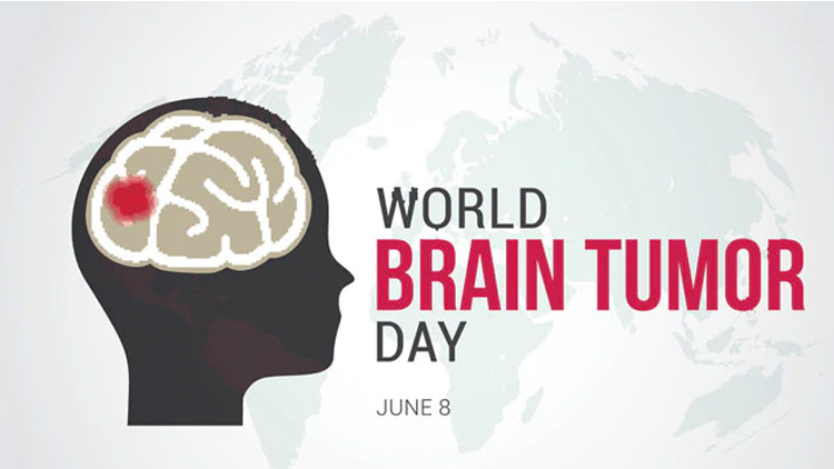 World brain. Мировой мозг. Всемирный день мозга (World Brain Day). The World for Brain.