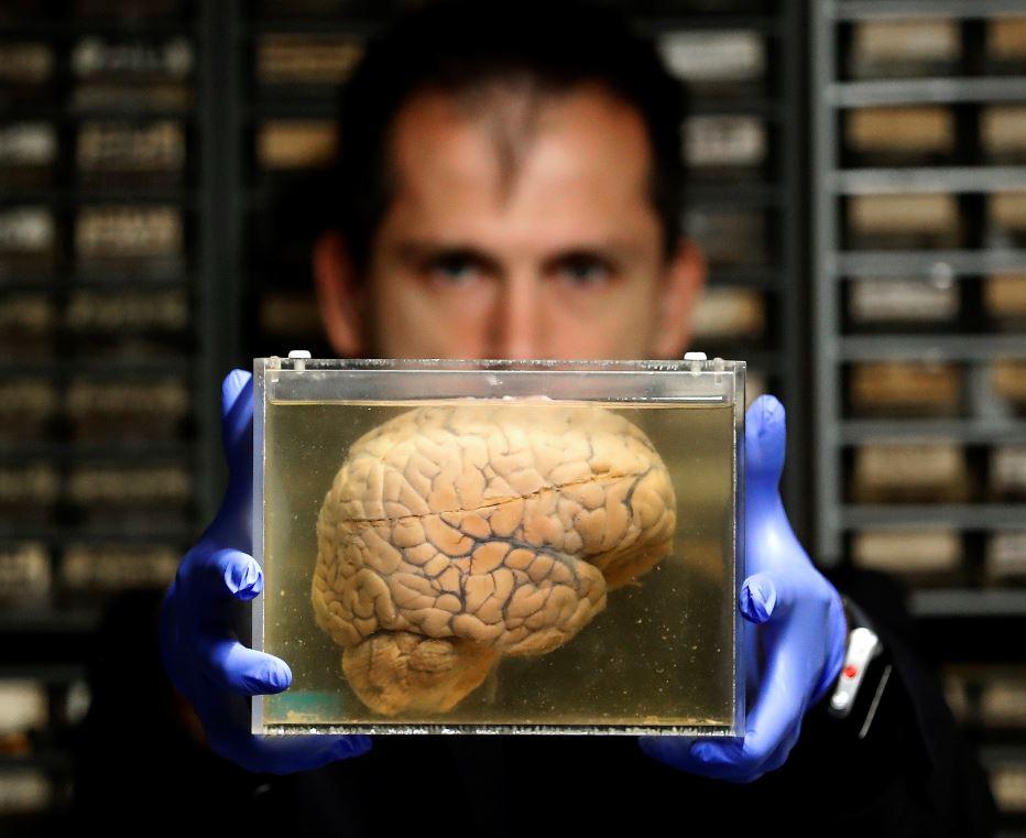 വി​ശ​പ്പി​നെ നി​യ​ന്ത്രി​ക്കു​ന്ന  മ​സ്​​തി​ഷ്​​ക കോ​ശ​ങ്ങ​ൾ ക​ണ്ടെ​ത്തി