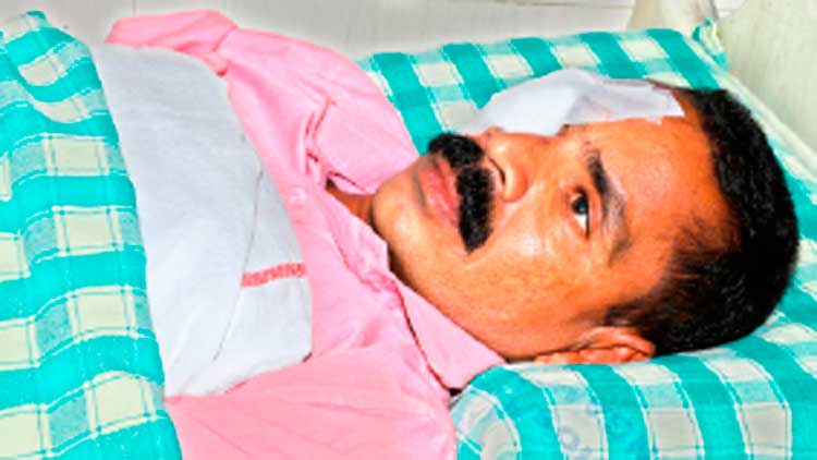 സൂക്ഷിക്കുക... പുല്ലുവെട്ട്​ യന്ത്രത്തിനരികിലും അപകടക്കെണി