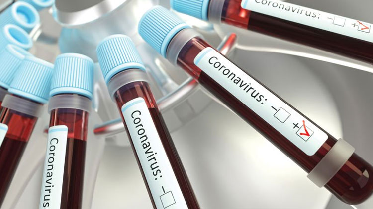 ഒമാനിൽ കോവിഡ്​ രോഗികൾ 66 ആയി