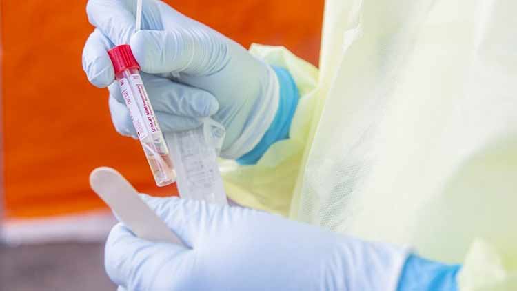 ഇൗജിപ്​തുകാരിയുടെ കൊറോണ കണ്ടെത്തിയത്​ മിഷ്​രിഫിലെ പരിശോധനയിൽ