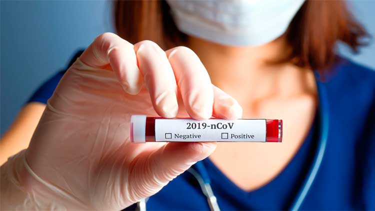 കൂടുതൽ കോവിഡ്​ പരിശോധന നടത്തിയ രാജ്യം കുവൈത്ത്​