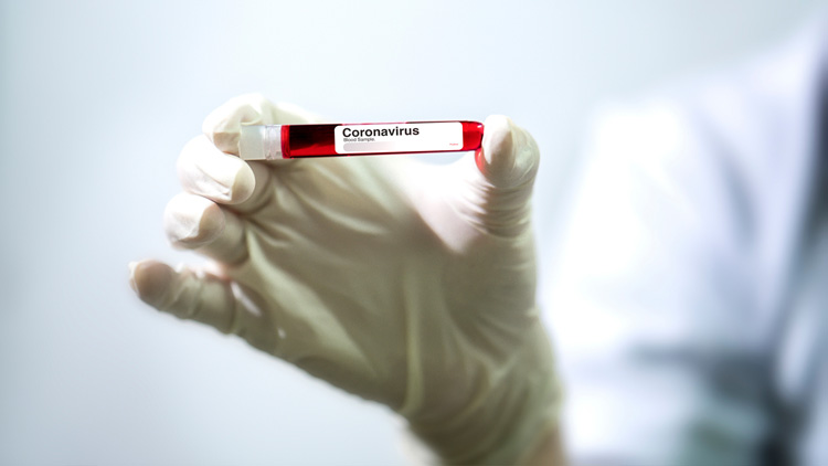 സൗദിയിൽ രോഗികളുടെ എണ്ണം 15000 കടന്നു; മരണം 127