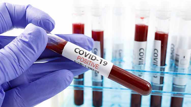 കർണാടകയിൽ നാലു കാസർകോട് സ്വദേശികൾക്ക് ഉൾപ്പെടെ എട്ടു പേർക്കുകൂടി േകാവിഡ്