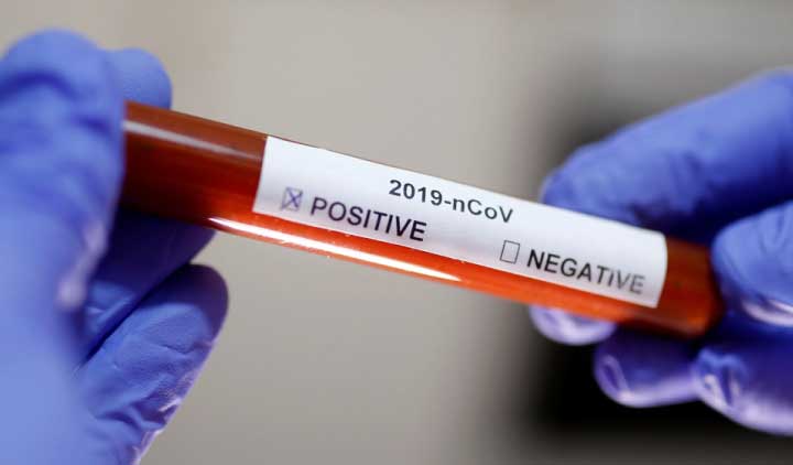 സ​മ്പ​ർ​ക്ക ശൃം​ഖ​ല ക​ണ്ടെ​ത്താ​ൻ ശ്ര​മം ഉൗ​ർ​ജി​തം: 71കാ​ര​നി​ൽ​നി​ന്ന്​ ആ​റു​പേ​ർ​ക്ക്​ രോ​ഗം പ​ക​ർ​ന്നു