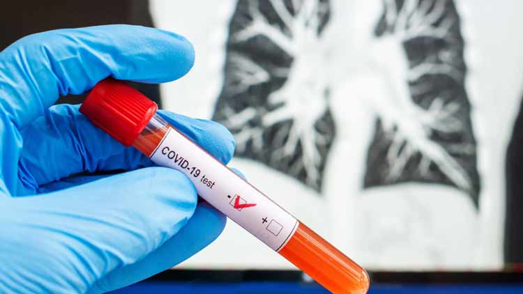 61 പേർക്ക് കൂടി രോഗമുക്തി; പുതിയ രോഗികളില്ല, ആശ്വാസത്തോടെ കേരളം 