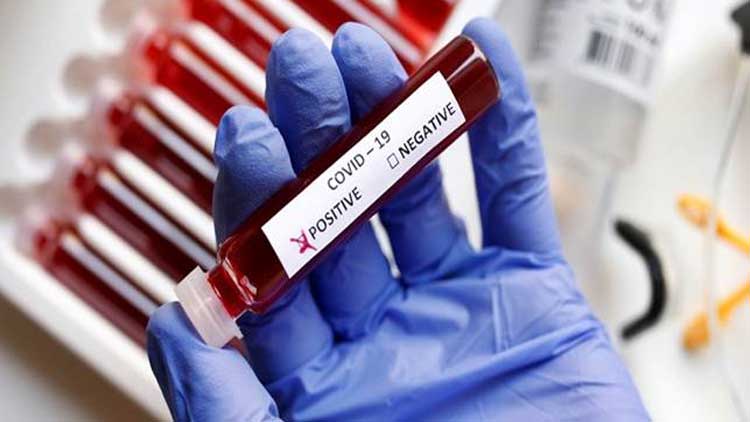 ടെ​സ്​​റ്റ്​ ചെ​യ്യാ​ത്ത​യാ​ൾ​ക്കും പോ​സി​റ്റീ​വ്; പി​ശ​കു​പ​റ്റി​യ​തെ​ന്ന് അ​ധി​കൃ​ത​ർ