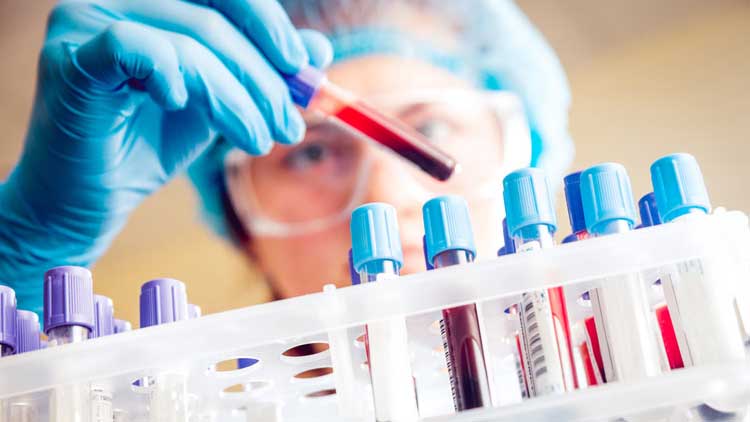 കോവിഡ് പരിശോധന നിരക്ക് ഏകീകരിക്കണം– സുപ്രീംകോടതി കോവിഡ് പരിശോധന നിരക്ക് ഏകീകരിക്കണം– സുപ്രീംകോടതി