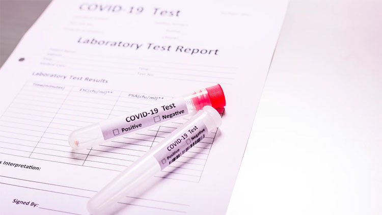 കോ​വി​ഡി​ല്ലാ സ​ർ​ട്ടി​ഫി​ക്ക​റ്റ്: നി​ബ​ന്ധ​ന​യി​ൽ 25 വ​രെ ഇ​ള​വ്​; ആ​ശ്വാ​സ​ത്തി​ൽ പ്ര​വാ​സ​ലോ​കം