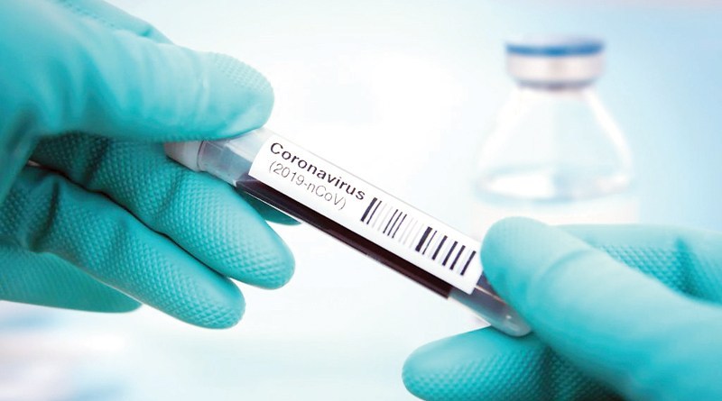 ഒമാനിൽ 811 പേർക്ക് കൂടി കോവിഡ് ഒമാനിൽ 811 പേർക്ക് കൂടി കോവിഡ്