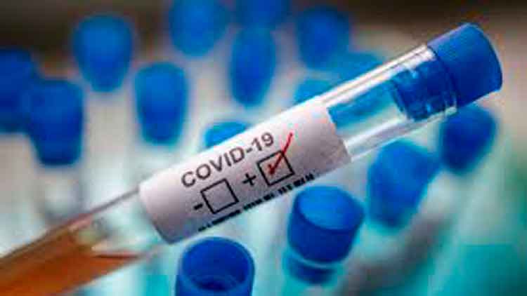 സൗദിയിൽ​ ഇന്ന്​ 22 മരണം, 1618 പുതിയ രോഗികൾ  