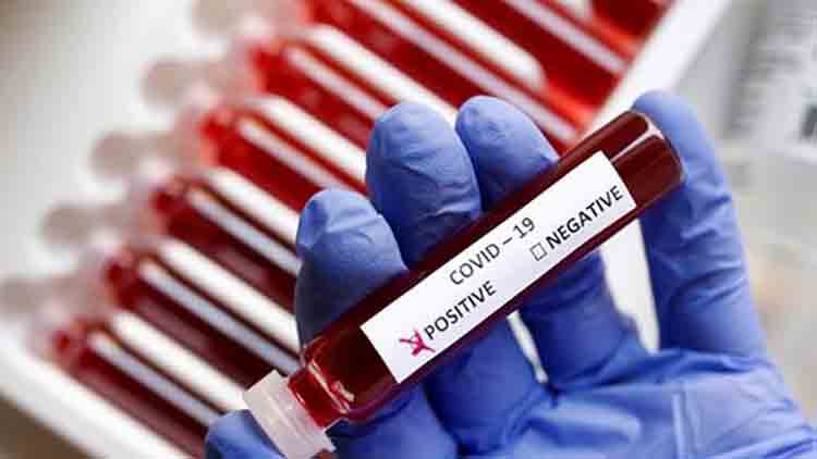 കോവിഡ് സ്ഥിരീകരിച്ചെന്ന് ഔദ്യോഗിക പ്രഖ്യാപനത്തിന്​ മുമ്പ് പ്രചരിപ്പിച്ചതായി പരാതി