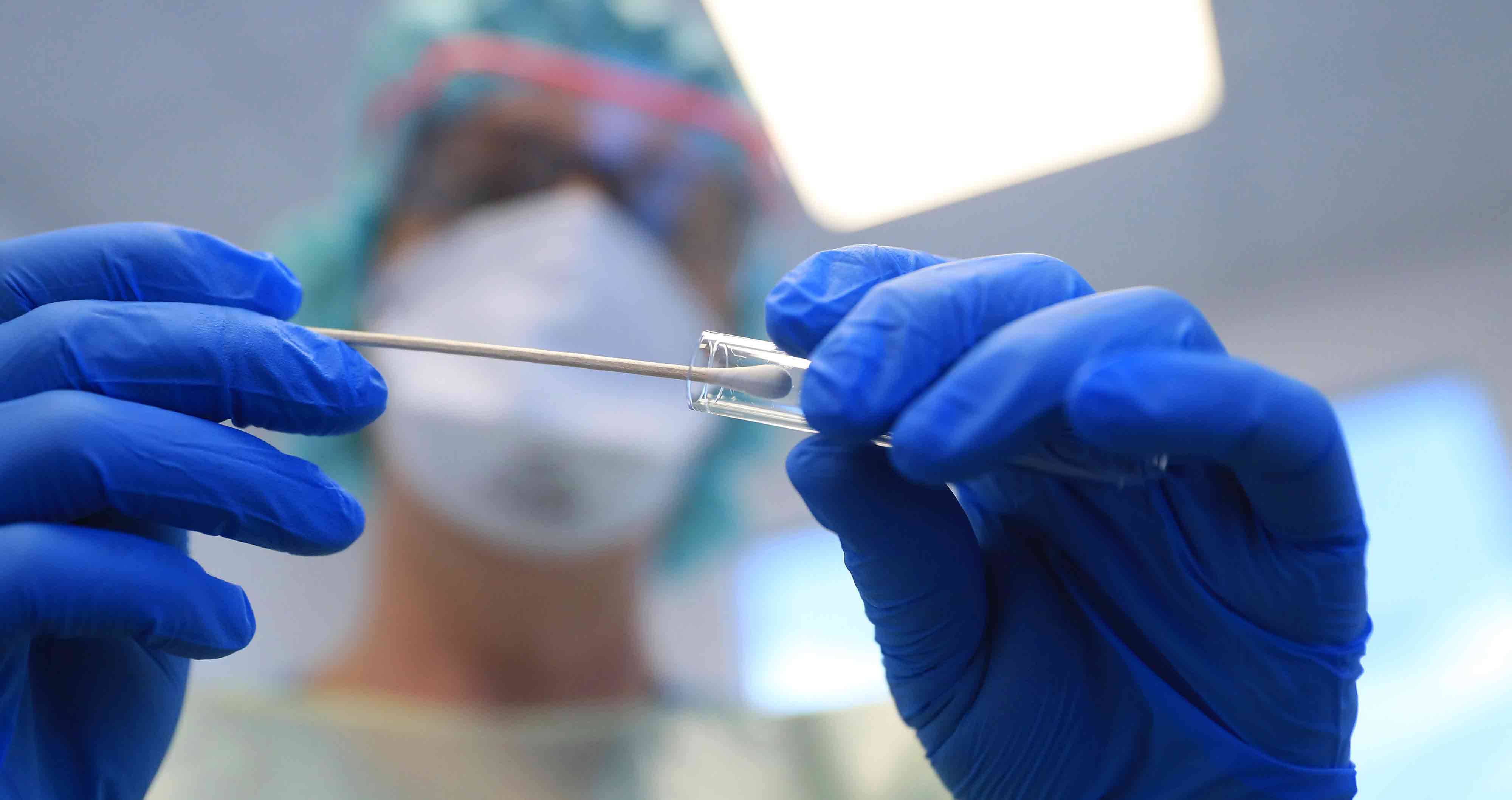 കോവിഡ്​ കണക്കുകൾ പുറത്തു വരുന്നതിനും മുകളിൽ; രോഗ പ്രതിരോധ ശേഷി സ്വയം ആർജിക്കുന്നതായും പഠനം