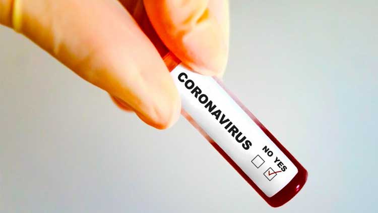 ലക്ഷദ്വീപിലും കനത്ത ജാഗ്രത; വിദേശ സഞ്ചാരികൾക്ക് വിലക്ക് ലക്ഷദ്വീപിലും കനത്ത ജാഗ്രത; വിദേശ സഞ്ചാരികൾക്ക് വിലക്ക്