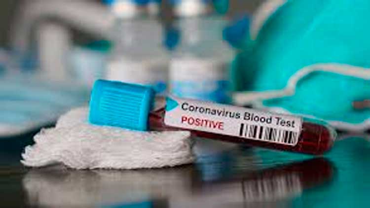 മി​ഷ്​​രി​ഫി​ലെ പ​രി​ശോ​ധ​ന​യി​ൽ  കോവിഡ്​ ക​ണ്ടെ​ത്തി​