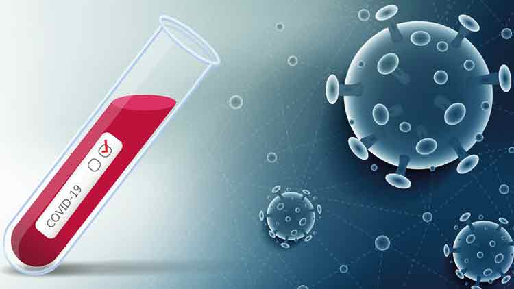 സംസ്​ഥാനത്ത്​ ഇന്ന്​ 506 പേർക്ക്​ കോവിഡ്, സമ്പർക്കം 375; ഫലങ്ങൾ ഉച്ചവരെയുള്ളത്​