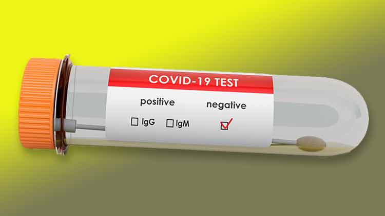 ഒമാനിൽ കോ​വി​ഡ്​ ഭേ​ദ​മാ​യ​വ​രു​ടെ എ​ണ്ണ​ത്തി​ൽ റെ​ക്കോ​ഡ്​ വ​ർ​ധ​ന 