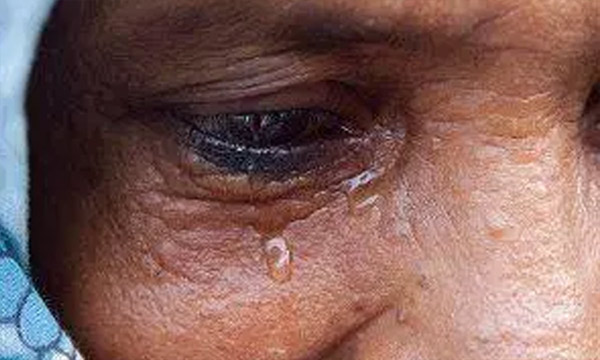 crying-eye crying-eye