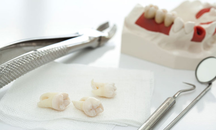 പ്രമേഹ രോഗികൾ സൂക്ഷിച്ചില്ലെങ്കിൽ പല്ല് പോകും