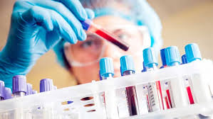 കോവിഡ് പരിശോധന; കേരളം ദേശീയ ശരാശരിയിൽ താഴെയെന്ന് കേന്ദ്രം