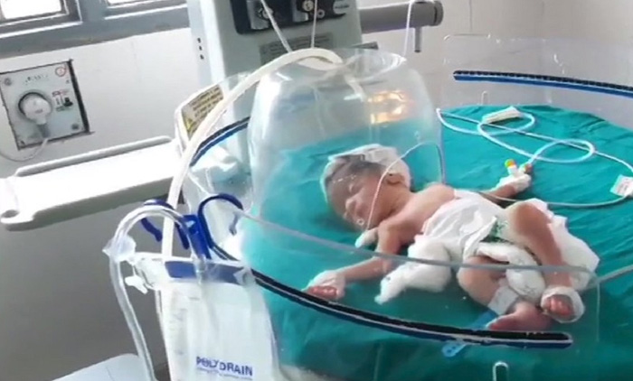 ഓവുചാലിലെറിഞ്ഞ ചോരക്കുഞ്ഞിന്​ രക്ഷകരായി തെരുവുനായ്​ക്കൾ