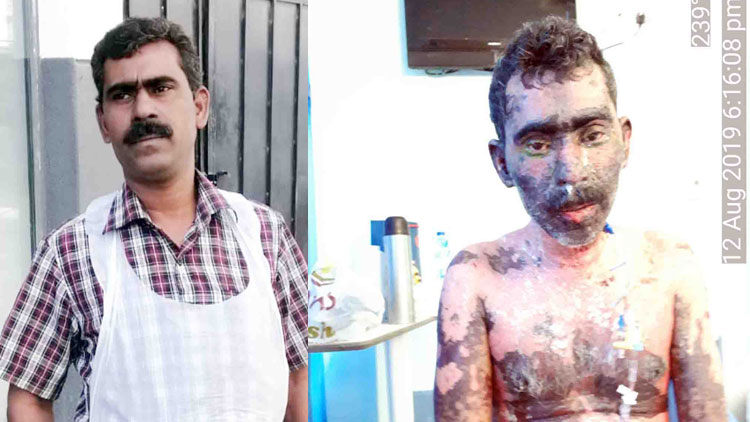 ജ​മാ​ലി​ന്​ നി​ങ്ങ​ളു​ടെ കാ​രു​ണ്യം  കൂ​ടി​യേ തീ​രൂ...