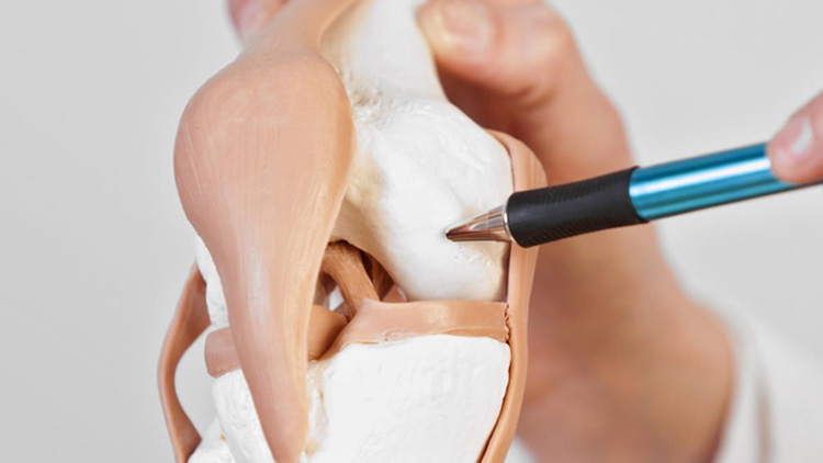 കാൽമുട്ട് മാറ്റിവെക്കൽ: ഇക്കാര്യങ്ങൾ അറിഞ്ഞിരിക്കാം