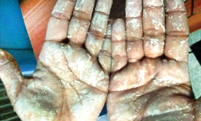 റേഷനരിയില്‍ മായം കലര്‍ന്നതായി പരാതി