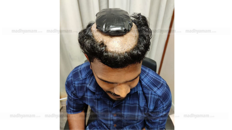 തലമുടിയിൽ ഒളിപ്പിച്ച് കൊണ്ടുവന്ന സ്വർണം നെടുമ്പാശ്ശേരിയിൽ പിടികൂടി