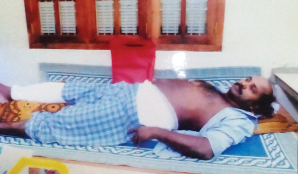 ആക്രമണത്തില്‍ പരിക്കേറ്റ നാരായണന്‍ രണ്ട് വര്‍ഷമായിട്ടും കിടക്ക വിട്ടില്ല