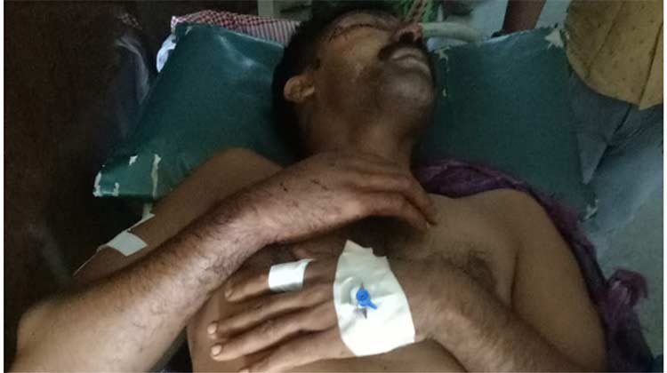 കർണാടകയിൽ രാത്രിയാത്രക്കിടെ മലയാളി ലോറി ഡ്രൈവർക്കുനേരെ ആക്രമണം