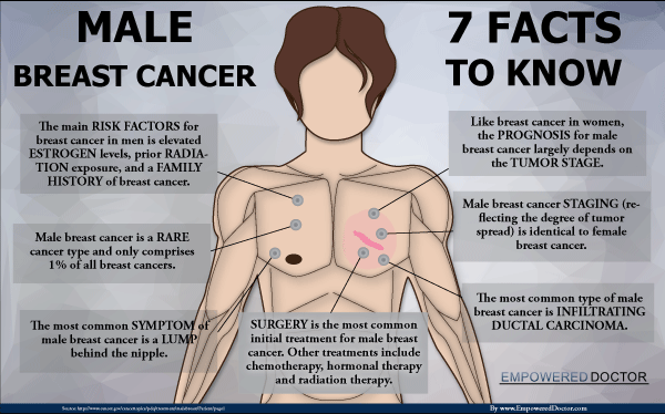 male-breast-Cancer