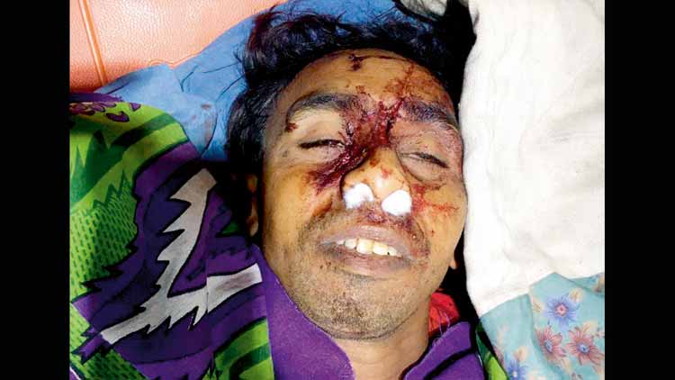 ജീവനോടെ കത്തിക്കു​​​​​േമ്പാഴും ചിരിച്ചിട്ടുണ്ടാകും മഹ്​താബ്