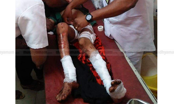 ആർ.എസ്.എസ് നേതാവി​െൻറ വീട്ടിൽ ബോംബ്​ സ്‌ഫോടനം; മകനുൾപ്പെടെ രണ്ടു കുട്ടികൾക്ക് പരിക്ക്