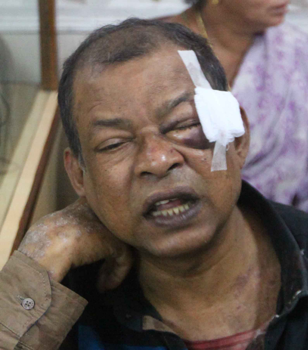 ട്രെയിനില്‍ കവര്‍ച്ച: ദമ്പതികള്‍ക്ക് ഗുരുതര പരിക്ക്; രണ്ടുപേര്‍ പിടിയില്‍